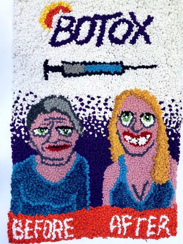 Image of artwork titled "Botox" by Megan Dominescu
