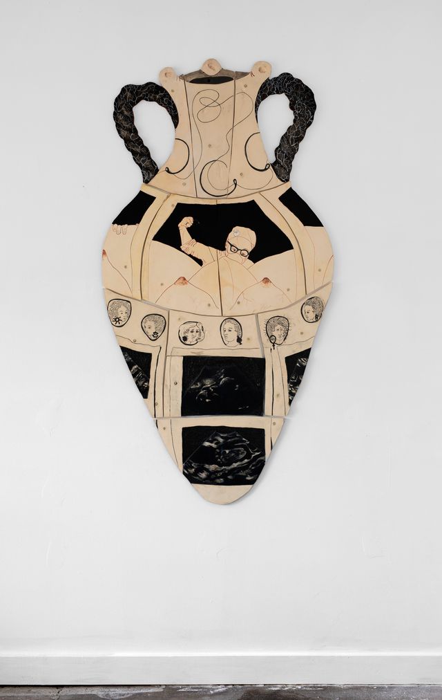 Image of artwork titled "Amphora with Stitches and Ultrasounds" by Gabriela Vainsencher