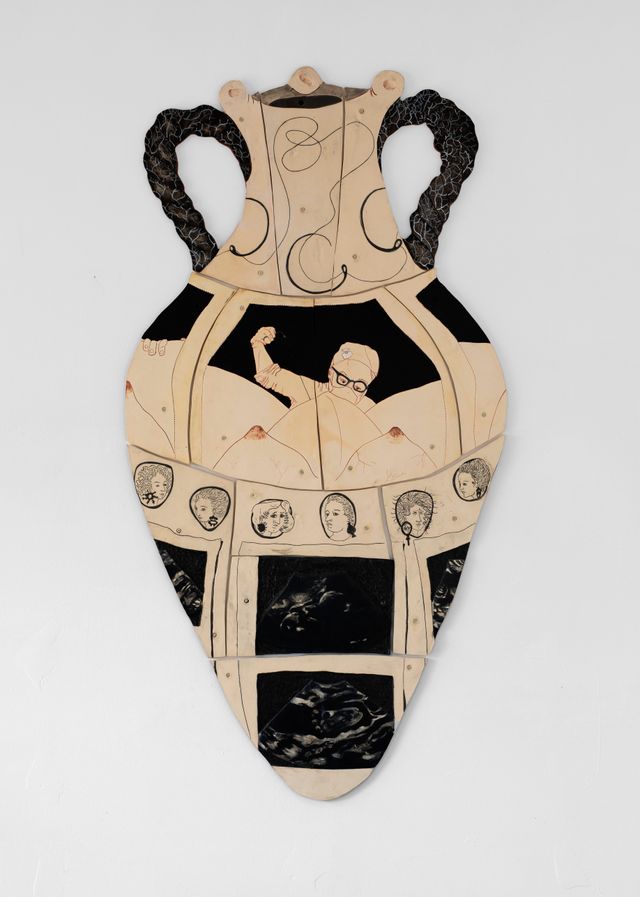 Image of artwork titled "Amphora with Stitches and Ultrasounds" by Gabriela Vainsencher